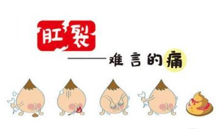 南寧肛裂怎么治療專(zhuān)業(yè)