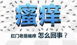 肛門瘙癢治不好嗎？先檢查病因就好辦！
